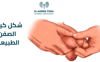 عملية تصغير كيس الصفن واسباب تغير شكل كيس الصفن الطبيعي