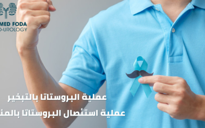 عملية البروستاتا بالتبخير – عملية استئصال البروستاتا بالمنظار 