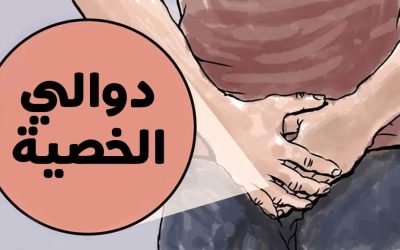 ما هي اعراض دوالي الخصية؟