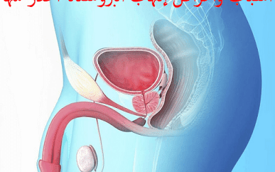 التهاب البروستاتا وعدم القذف