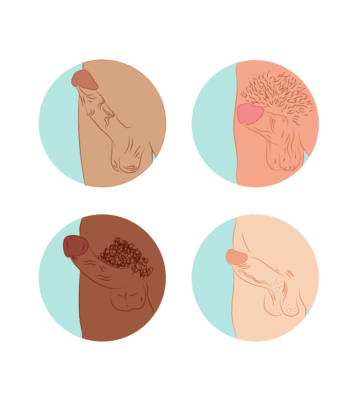 احتقان القضيب