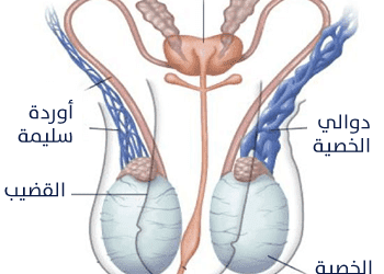هل دوالي الخصية تسبب العقم؟