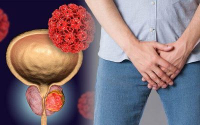 أعراض تضخم البروستاتا الخبيث