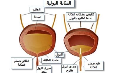 أسباب احتباس البول وأشهر أعراضه لدى الرجال