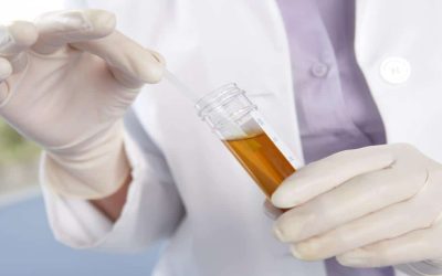 أسباب نزول دم مع البول