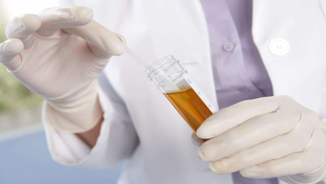 أسباب نزول دم مع البول