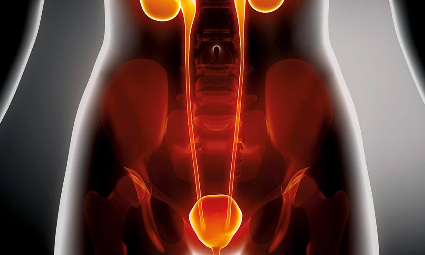 حرقان في البول حرقان في البول