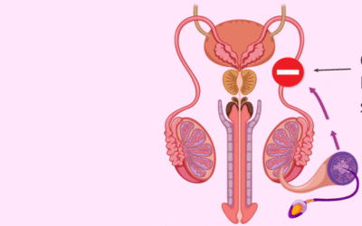قطع الحبل المنوي
