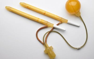 عملية الدعامة للانتصاب