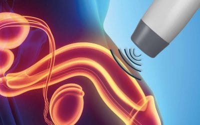 سعر جهاز الانتصاب