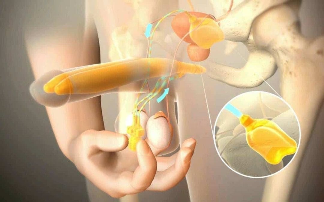 افضل طبيب دعامات للقضيب في العالم 2023