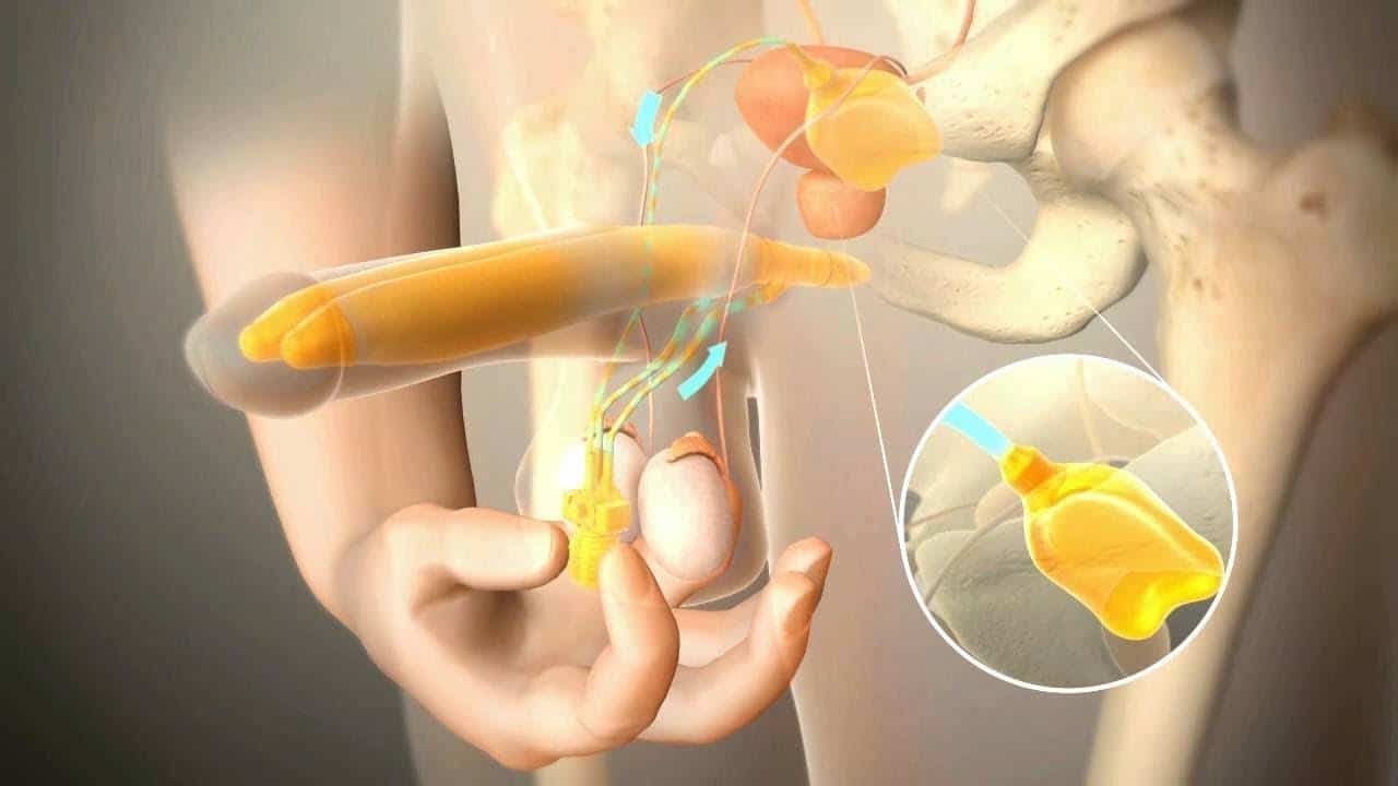 افضل طبيب دعامات في العالم