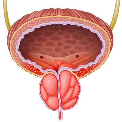 علاج التهاب بروستاتا مزمن