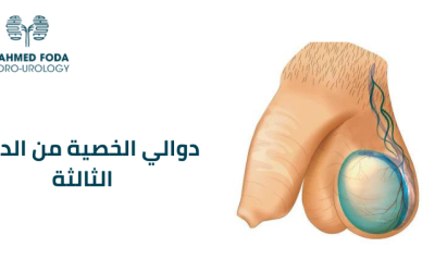 دوالي الخصية من الدرجة الثالثة