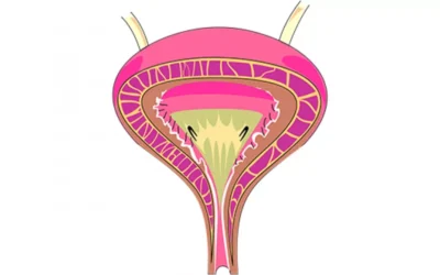 زرع صمام عنق المثانة عند الرجال والنساء