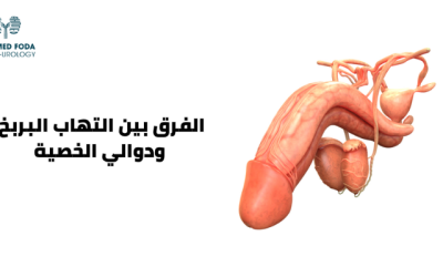 الفرق بين التهاب البربخ ودوالي الخصية تعرف عليه الآن