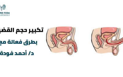 عملية تكبير حجم القضيب