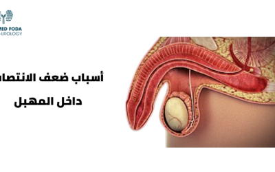أسباب ضعف الانتصاب داخل المهبل