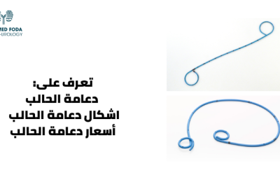 شكل دعامة الحالب وكيفية تركيبها؟