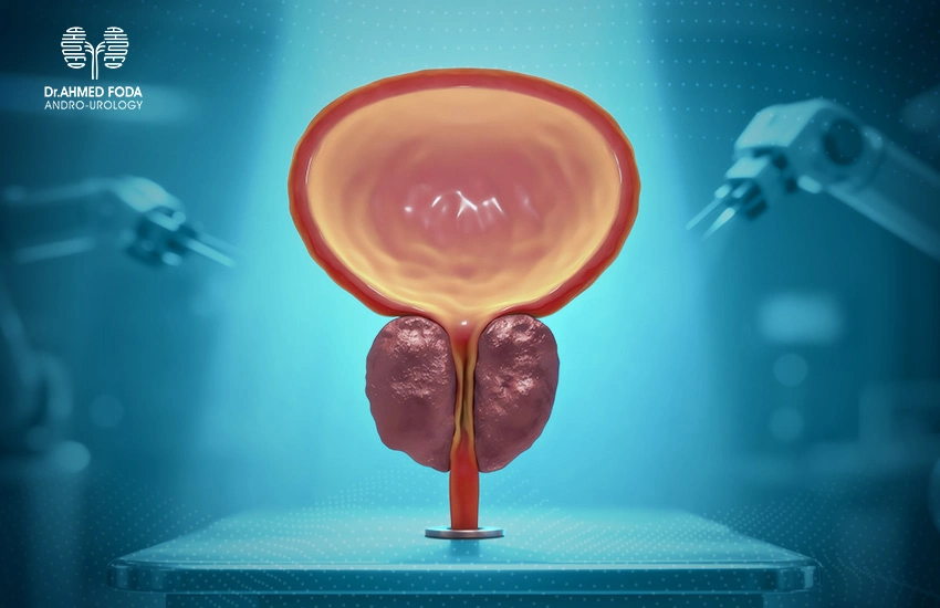عملية استئصال البروستاتا